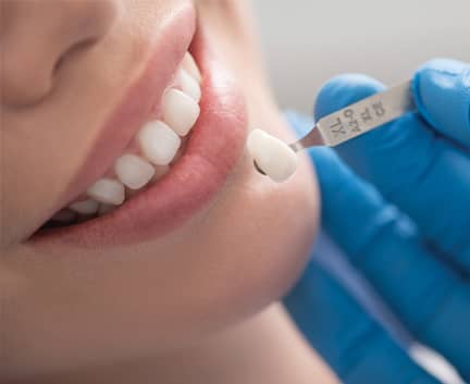 Treatment - Harley Private Dental