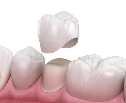 Treatment - Harley Private Dental