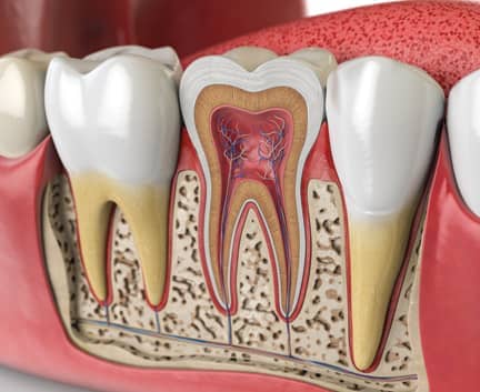 Treatment - Harley Private Dental