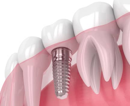 Treatment - Harley Private Dental