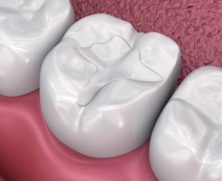 Treatment - Harley Private Dental